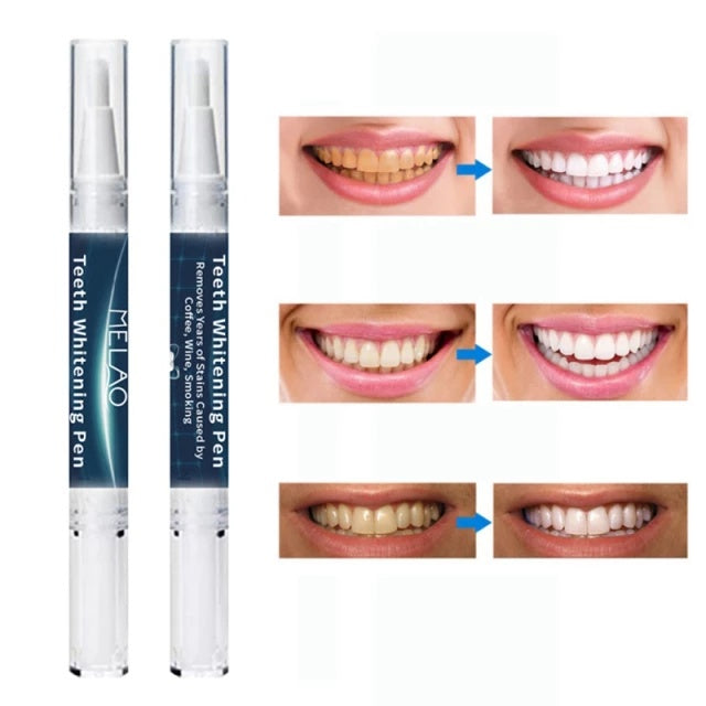 MELAO Teeth Whitening Gel Pen Yellow Teeth Dental Plaque Brighten Teeth Oral Care  Tooth Cleaning