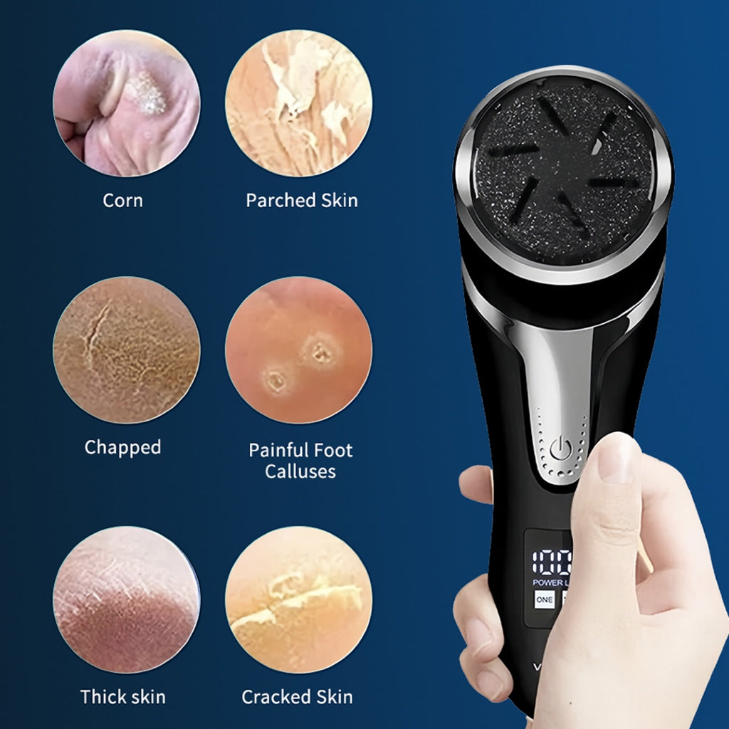 Electric Foot Rasp Callus Remover | Rechargeable Pedicure Tool with Vacuum System | Waterproof IPX7 Foot File with LED D