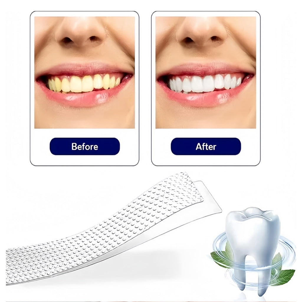5D Teeth Whitening Strips | Professional Dental Care Whitening Kit for Home Use | Easy Peel
